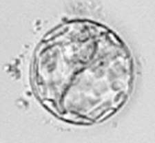 Embryo egg fertilization