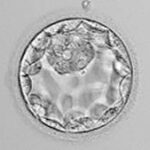 Embryo egg fertilization