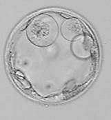 Embryo egg fertilization