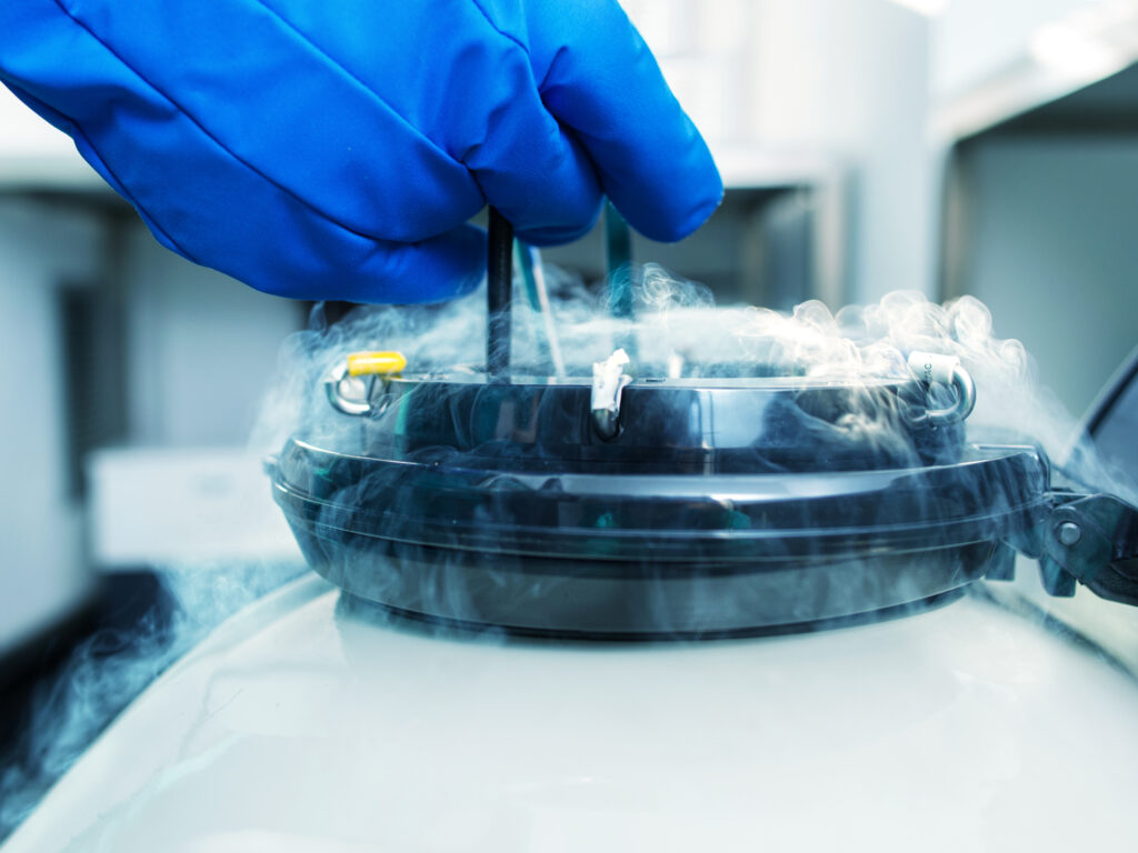 Sample of sperm frozen tank