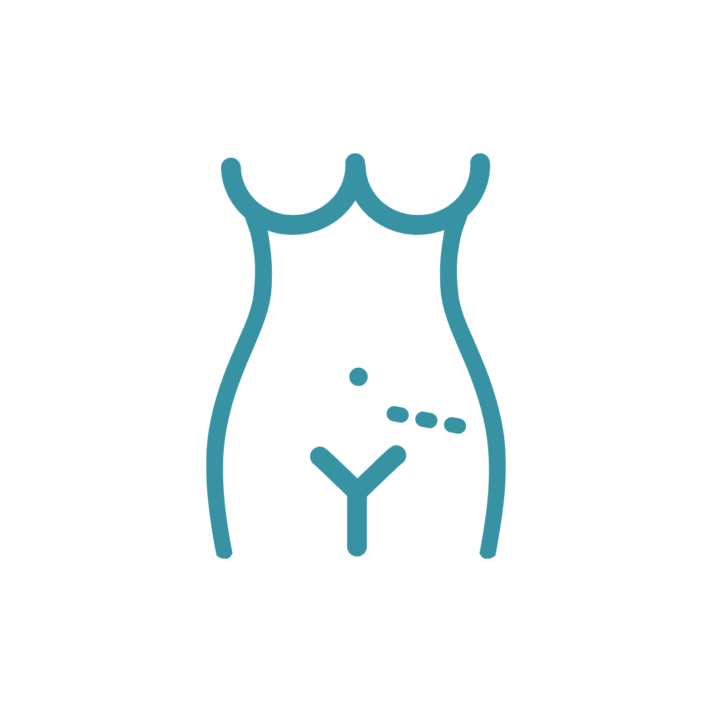 Laparoscopy