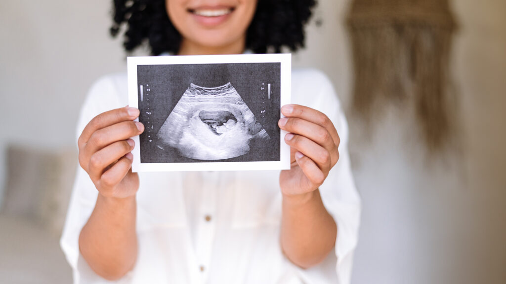 Happy woman holding in hands sonography photo of baby