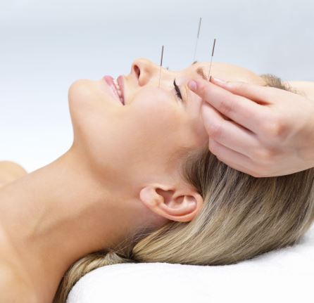 acupunture fertility