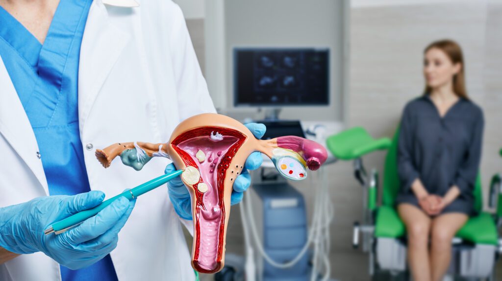 Uterine fibroid, myoma. Gynecologist pointing uterine leiomyomas on anatomical model of uterus while female patient’s gynecological consultation