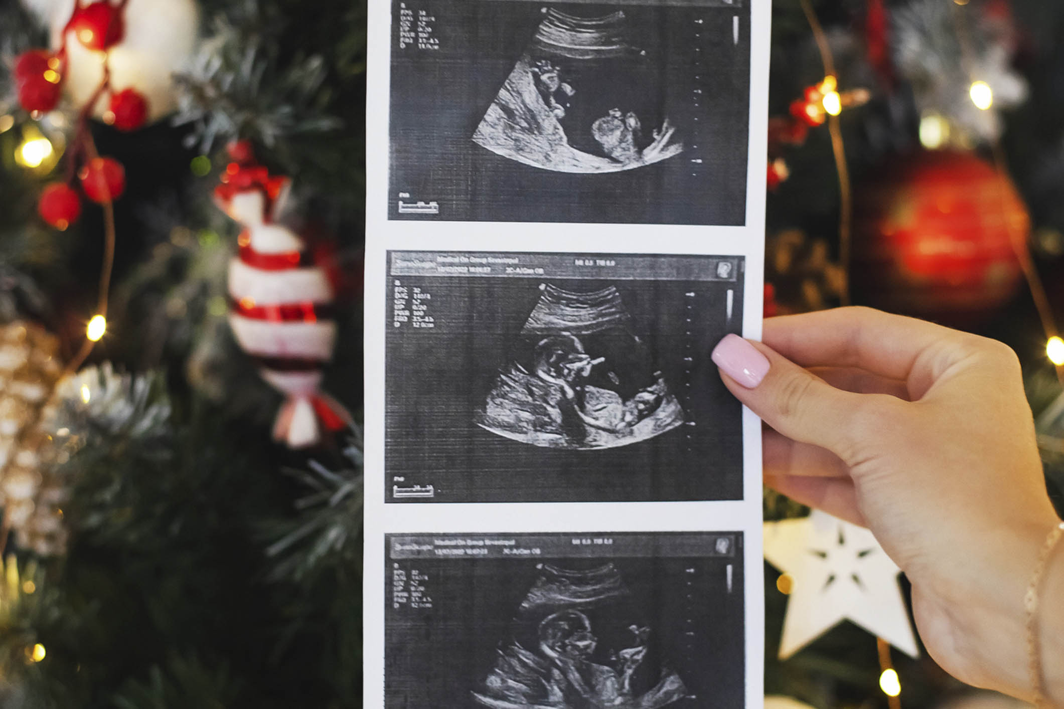 Two black and white pregnancy ultrasound scan pictures Expecting Mother Holding ultrasound photos