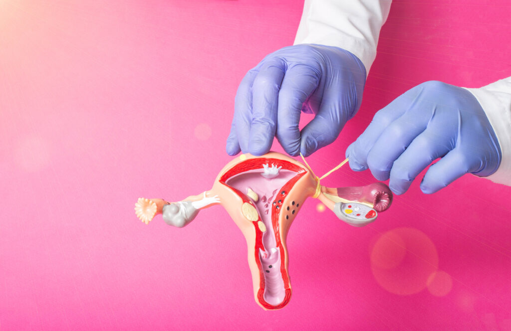 Doctor gynecologist ligates the fallopian tubes on the example of the layout of the female reproductive system, pink background. Contraception concept for unwanted pregnancy, copy space for text