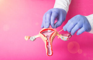 Doctor gynecologist ligates the fallopian tubes on the example of the layout of the female reproductive system, pink background. Contraception concept for unwanted pregnancy, copy space for text